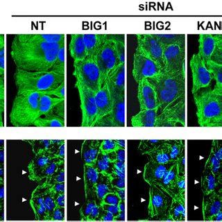 Effects Of BIG1 BIG2 KANK1 Or KIF21A Depletion On Intracellular