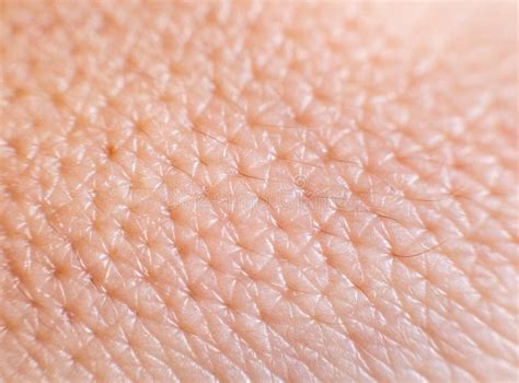 Closeup Of Porous Oily Human Skin Large Pores On The Skin Background