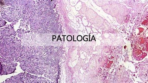 O Que É Patologia Exemplos - QUE ES PATOLOGIA