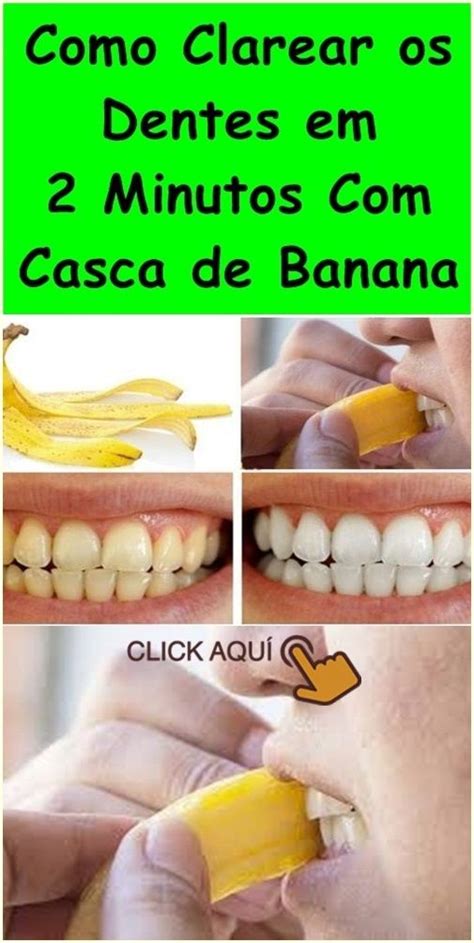 Como Clarear Os Dentes Em Minutos Casca De Banana Aprenda Em