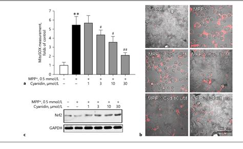 Figure 1 From Cyanidin Protects Sh Sy5y Human Neuroblastoma Cells From