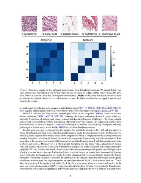 The Whole Pathological Slide Classification Via Weakly Supervised