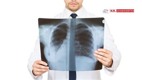 Normal Chest X Ray Hr Diagnostic