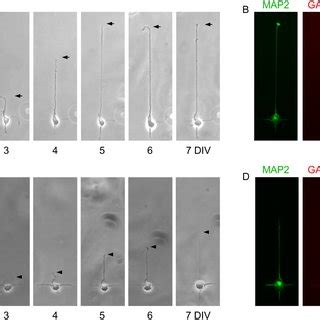 Development of non-GABAergic and GABAergic cortical neurons on ...