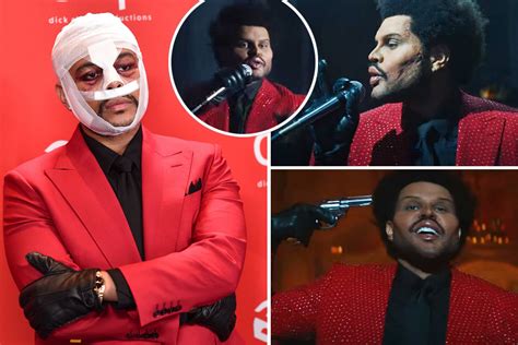 The Weeknd Shows Off Freaky Face From Plastic Surgery In New Music Video After Wearing Bizarre