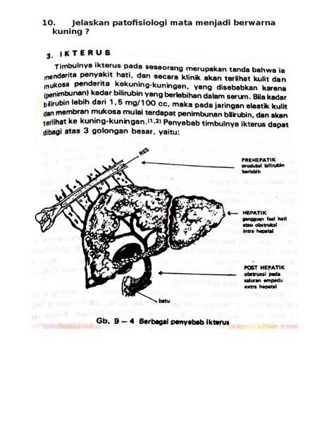 Patofisiologi Ikterus Dan Hubungan Penyakit Maag Dan Penyakit Hati