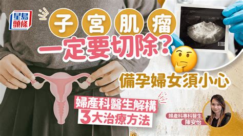 患子宮肌瘤一定要做手術？備孕婦女須小心 婦產科醫生解構3大治療方法