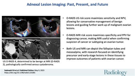 Adnexal Lesion Imaging Past Present And Future Radiology