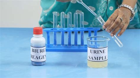 Biology 1st Puc Laboratory Biochemical Test Urine Test S09