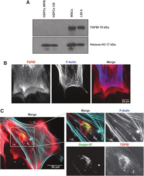 Tgfbi Expression In Bm Stromal Cells A Tgfbi Protein Expression In