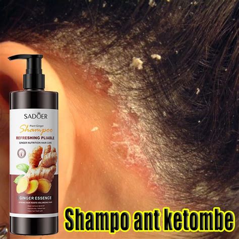 Jual Shampoo Anti Ketombe Shampo Jahe Shampo Anti Ketombe Dan Rontok