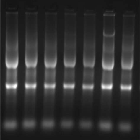 Ethidium Bromide Stained Agarose Gel Showing Intact Extracted Rna From