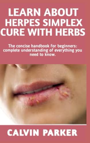 Learn About Herpes Simplex Cure With Herbs Concise Manual Symptoms