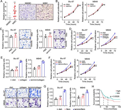 Laminin Promoted Cell Proliferation And Migration In Bladder Cancer A