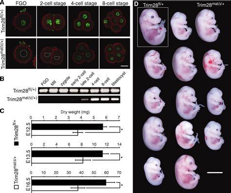 Trim Is Required For Epigenetic Stability During Mouse Oocyte To