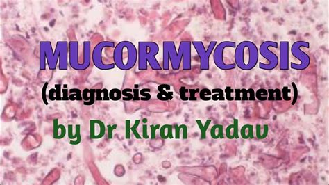 Microbiology Lectures Mucormycosis Diagnosis Treatment Mycology