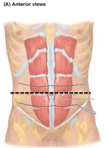 Anterior Abdominal Wall Flashcards Quizlet