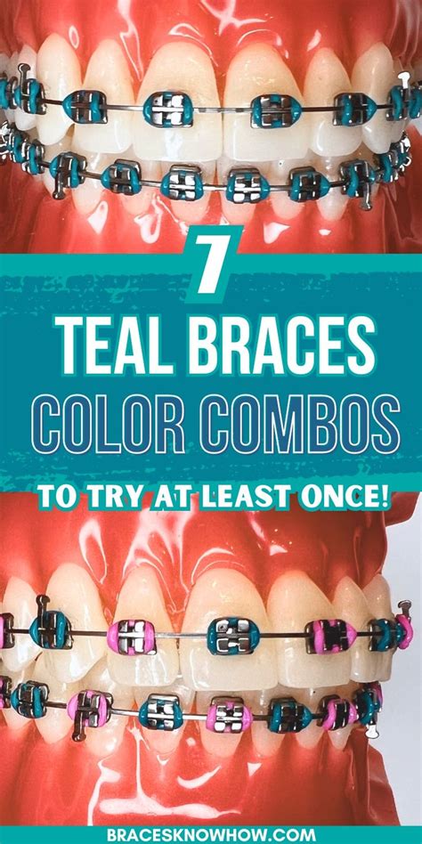 Teal Braces 7 Color Combos To Match Your Personality In 2024 Braces Colors Colors For Dark