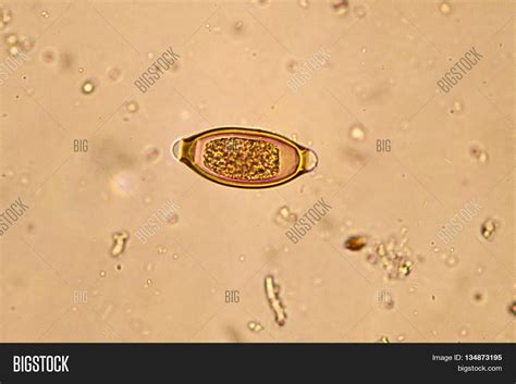 Egg Trichuris Image And Photo Free Trial Bigstock