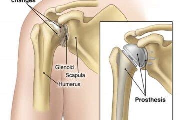 Manik Orthocare Orthopedic Joint Replacement Arthroscopy Surgeon