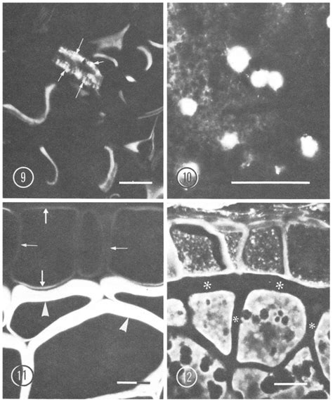 Calcofluor Stained Micrographs Of Sections Of Methylacylateembedded Download Scientific Diagram