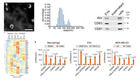 Nature Cell Biology外泌体LncRNA帮助免疫细胞叛变 乳腺ai恶化新机制