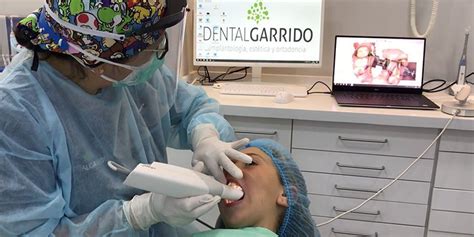 Qu Es Un Esc Ner Intraoral Y Sus Beneficios Garrido