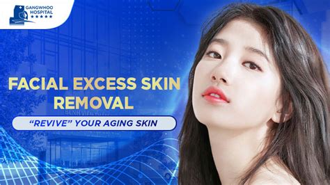 Facial Excess Skin Removal – Bring back your youthful beauty - Gangwhoo ...