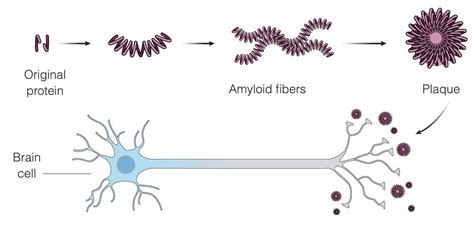 What Is Aduhelm Aducanumab New Alzheimer S Medicine Information Faq