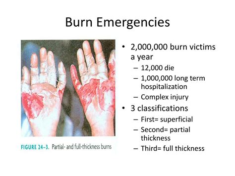 Ppt Module Emergency Procedures Powerpoint Presentation Free