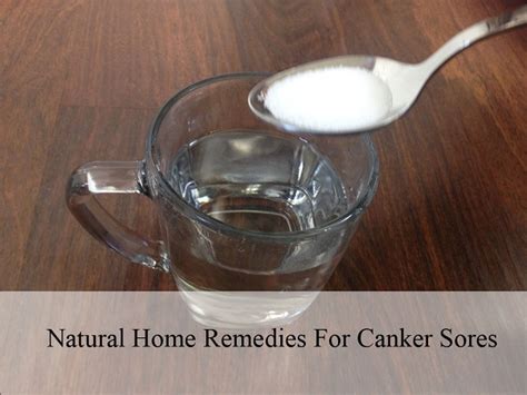 Natural Home Remedies For Canker Sores | RitiRiwaz