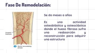 etapas de la consolidación osea PPT