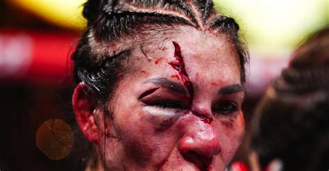 Irene Aldana Shares Healing Update On Insane Cuts Suffered At Ufc