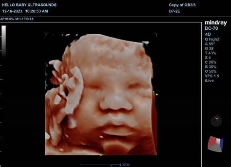 Home Ultrasounds SneakPeek Gender Testing IV Infusions About Gift card Q & A Contact Us More