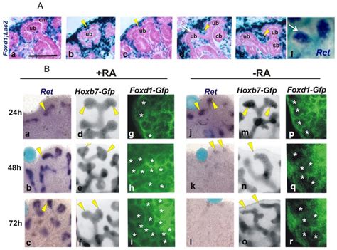 Histological Sections Of Foxd Lacz Kidneys During Embryonic