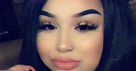 Woman claims botched fillers left her with 'lips like grapes' and fears ...