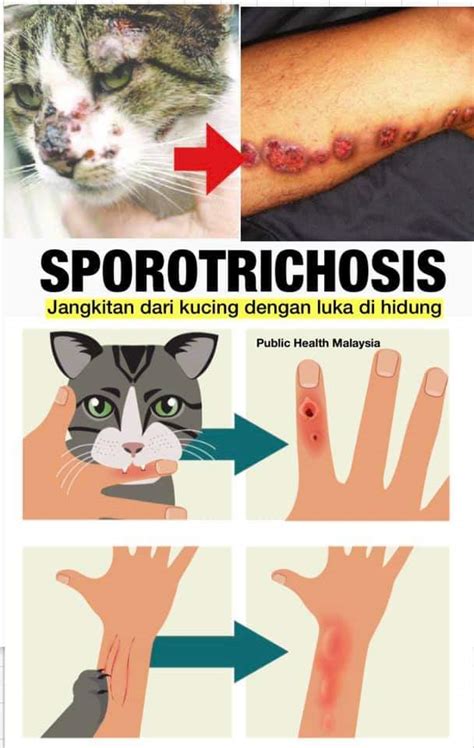 Sporotrichosis Jangkitan Dari Kucing Dengan Luka Di Hidung Yang Boleh