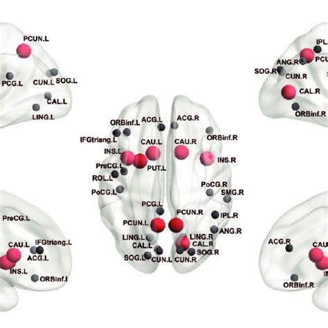 Adhd Related Alterations In Nodal Efficiency Show Regions With