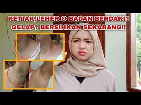 Cara Sangat Ampuh Mencerahkan Kulit Ketiak Leher Lipatan Seluruh