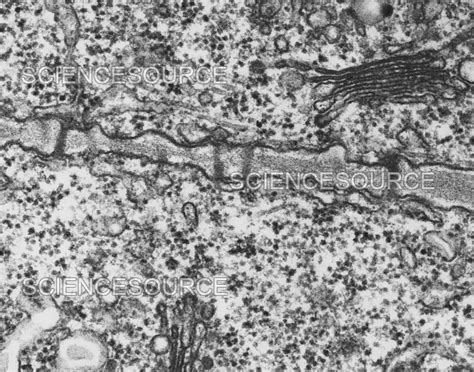 Cell Membrane Electron Micrograph