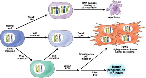 Timing Is Everything Brca2 And P53 Mutations In Pancreatic Cancer