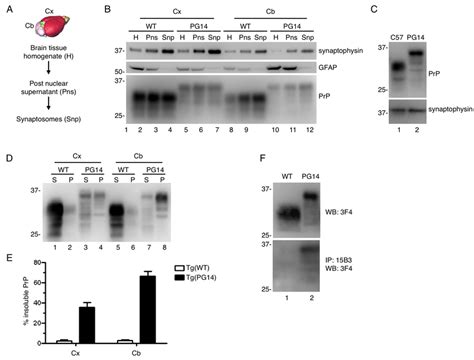 Figure S2 PG14 PrP From Synaptosomal Fractions Is Detergent Insoluble