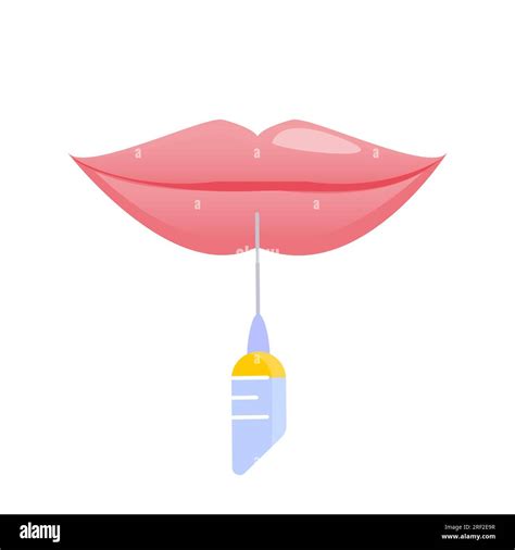 Lip Plumping Augmentation With Filler Injection Illustration Stock