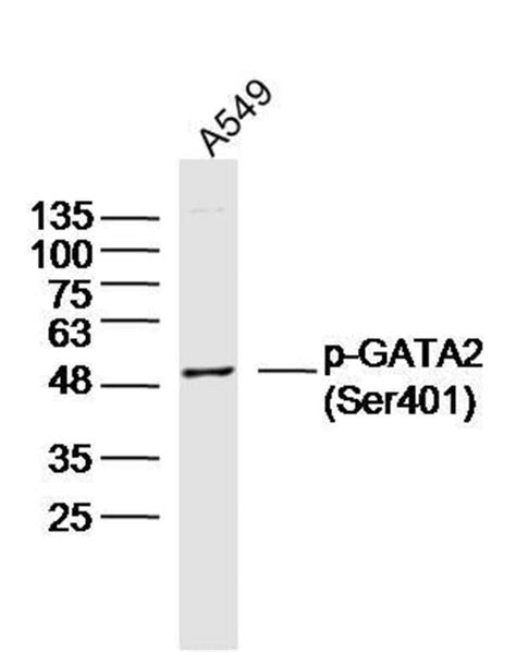 Phospho Gata Ser Rabbit Anti Human Polyclonal Bioss L