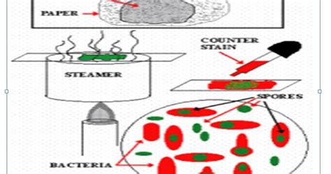 Protocol For Spore Staining ~ Dhiraj's Blog