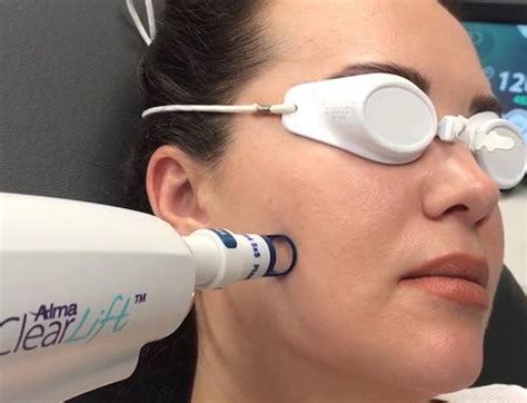 ClearLift Laser Facelift Jill Zander Atelier Yuwa Ciao Jp