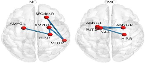 Ordinal Patterns Of Nc And Early Mild Cognitive Impairment Patients