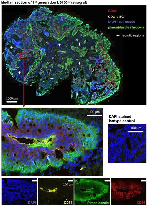 Cd44 Tumor Cells Are Located In Well Oxygenized But Not In A Proposed Download Scientific