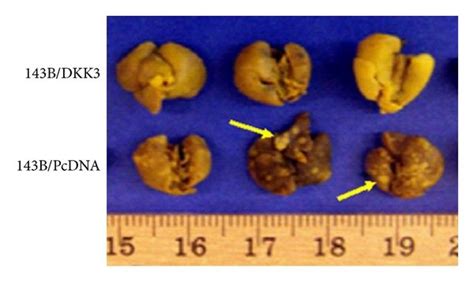 In Vivo Dkk Inhibits Tumor Growth In Nude Mice And Decreases