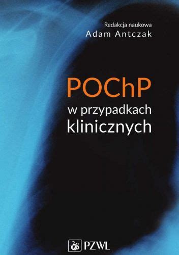 POChP w przypadkach klinicznych Adam Antczak Książka w Lubimyczytac